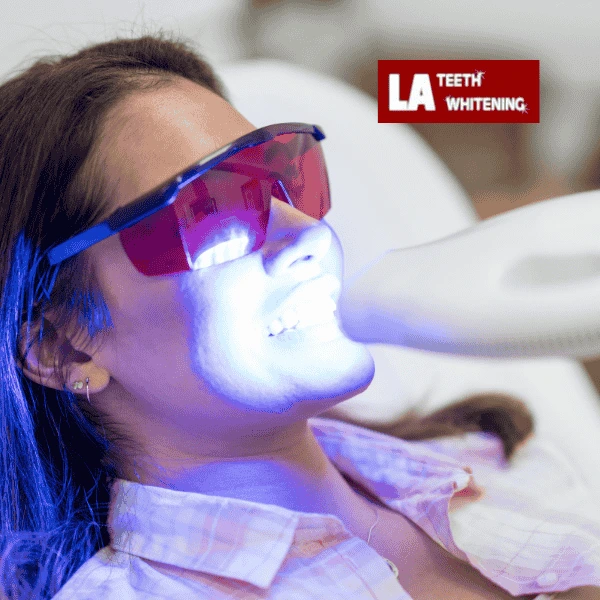 Contact LA Teeth Whitening Today! Book your appointment!Contact LA Teeth Whitening Today! Book your appointment! Waterlooville