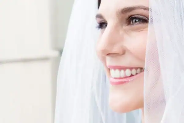 LA teeth whitening for special occasions Waterlooville